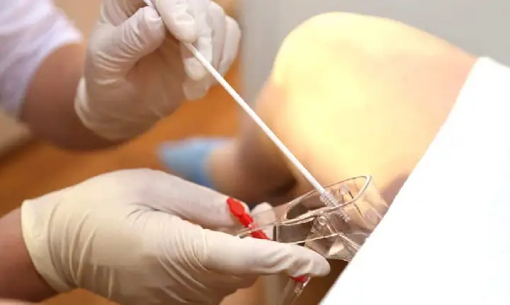 SUS vai substituir papanicolau por exame mais moderno de rastreio de HPV ainda este ano