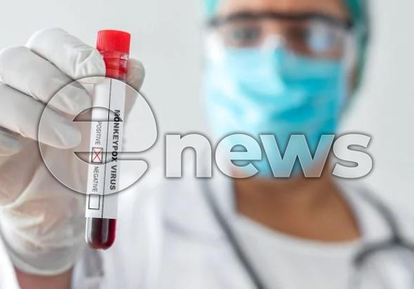 Ministério da Saúde investiga 2 casos suspeitos de varíola dos macacos no Brasil