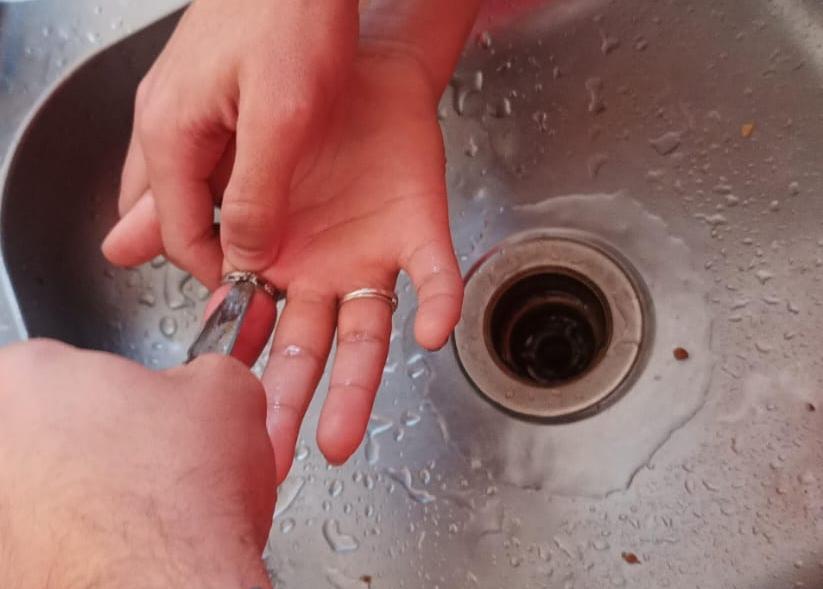 Bombeiros de Campos Altos removem anel que estava preso no dedo de adolescente