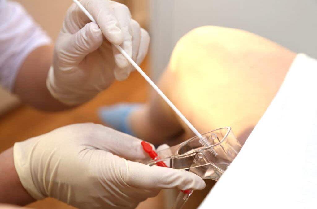 SUS vai substituir papanicolau por exame mais moderno de rastreio de HPV ainda este ano
